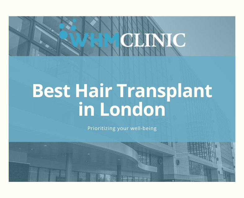 Best Hair Transplant in London