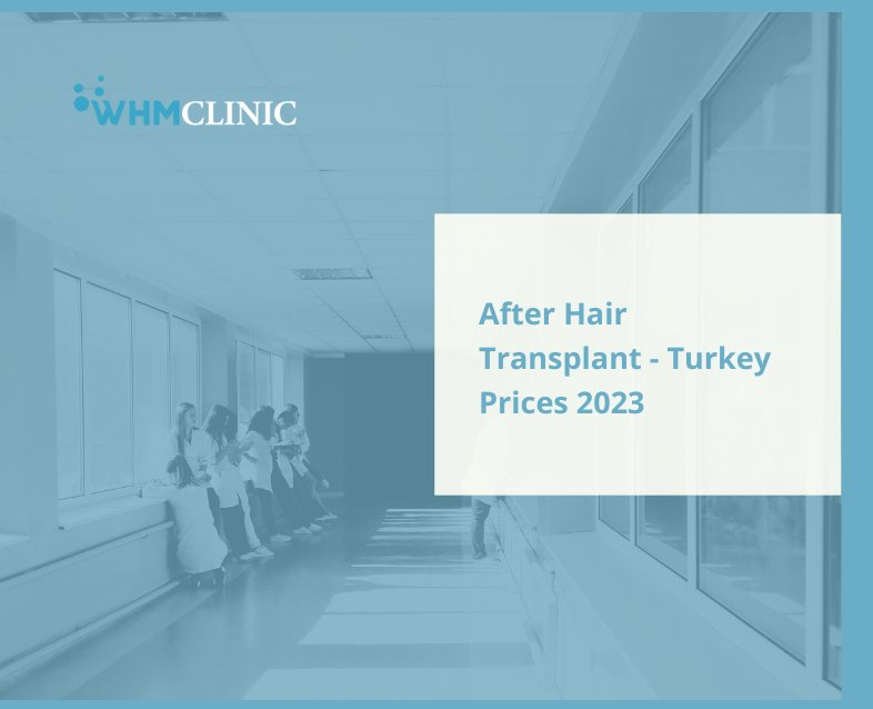 After Hair Transplant - Turkey Prices 2023